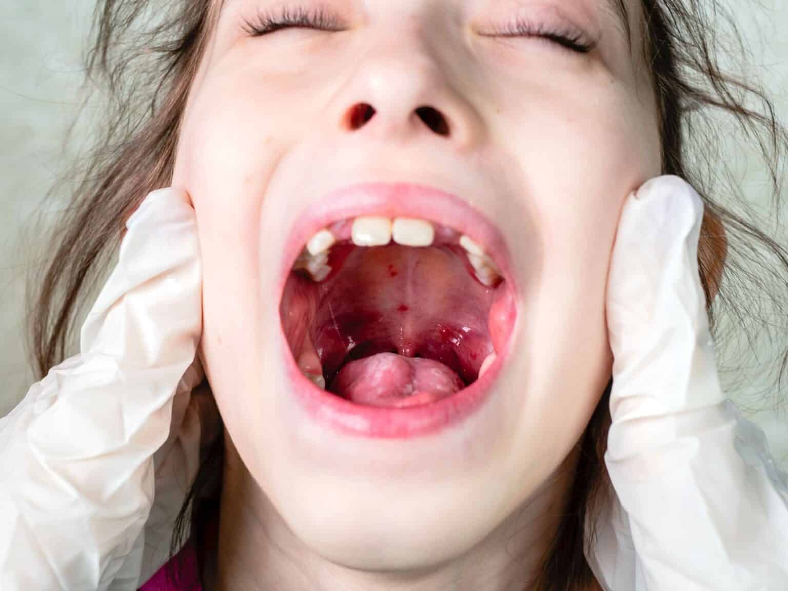 Guide essentiel Les infections buccales courantes chez les enfants — free download