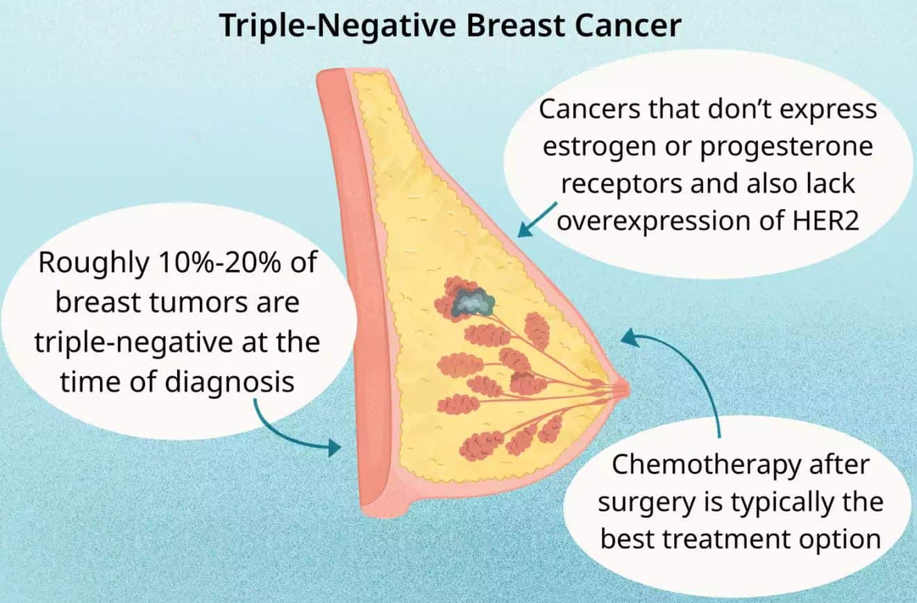 Triple-Negative Breast Cancer (TNBC)