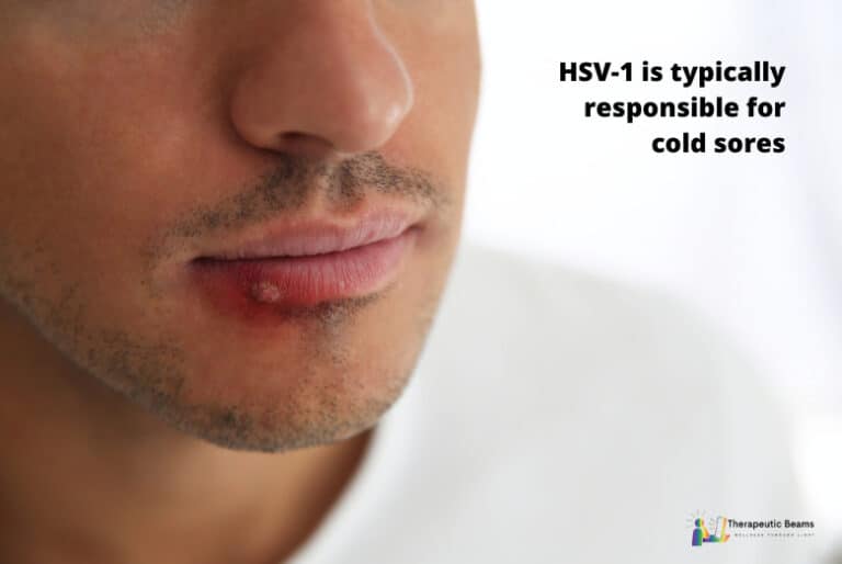 Red Light Therapy For Cold Sores Say Goodbye To Fever Blisters? Therapeutic Beams