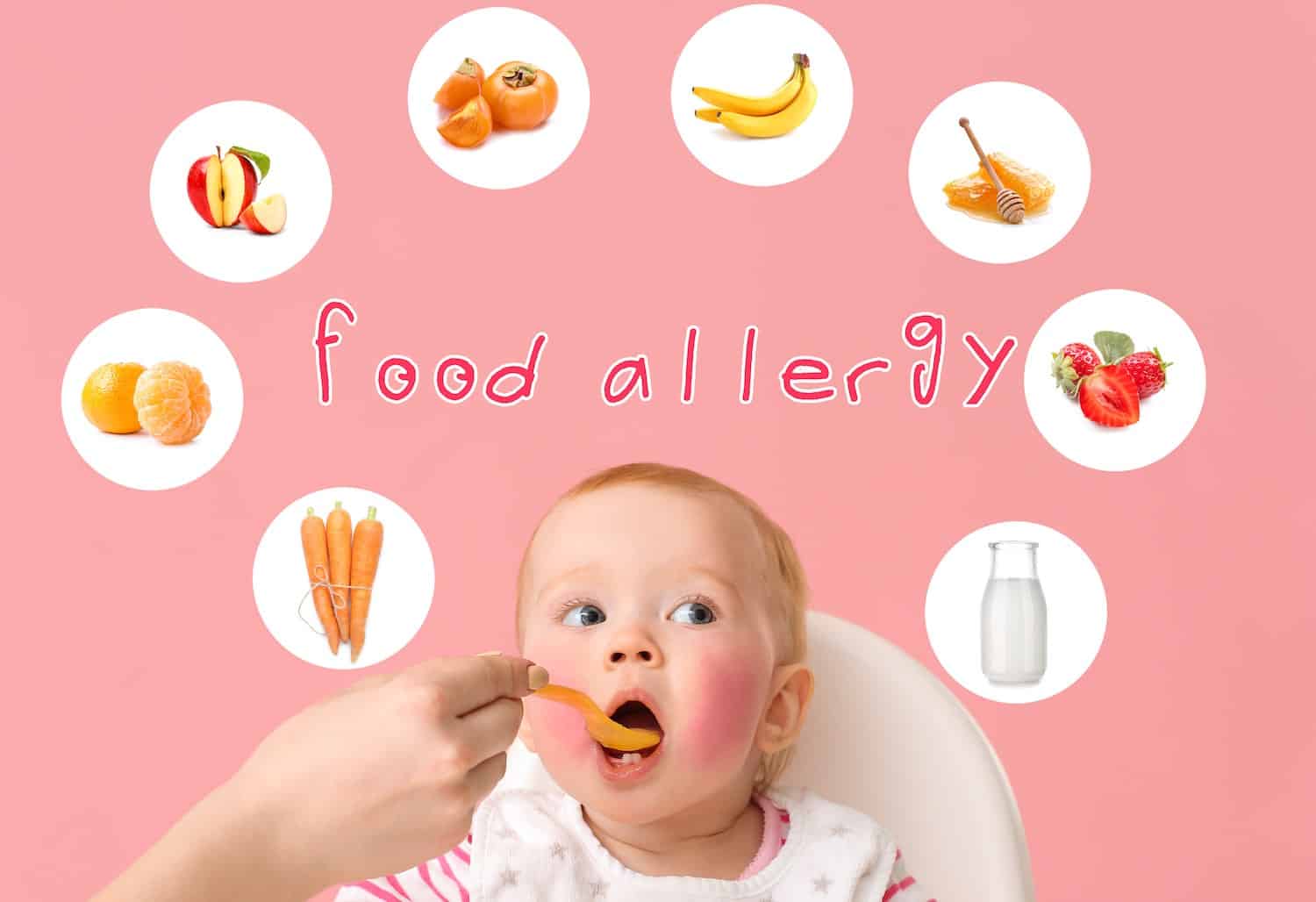 Food Allergy