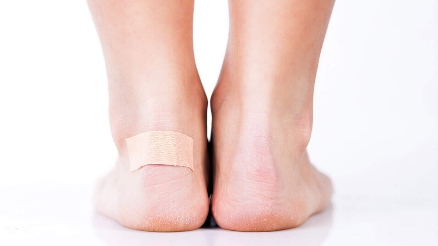 blasen druckstellen wandern