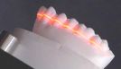 Dental Scanner 5 scanvorgang laserlinie 536x308 404b2a7f
