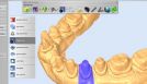 Dental Scanner 6 screenshot nachbearbeitung 1080x620 8704386d