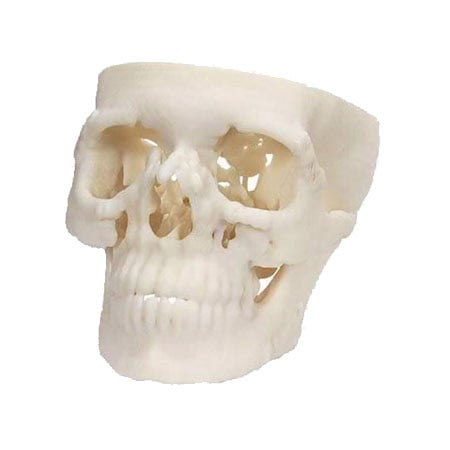 Rapid Prototyping 5 3d printed skull