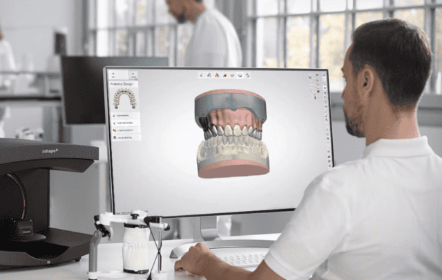 Digital Scan and CAD-Design