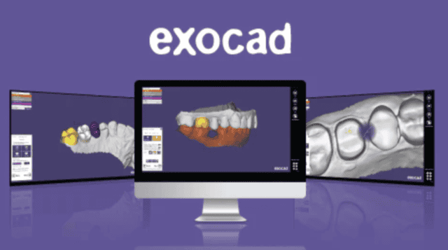 What is exocad?