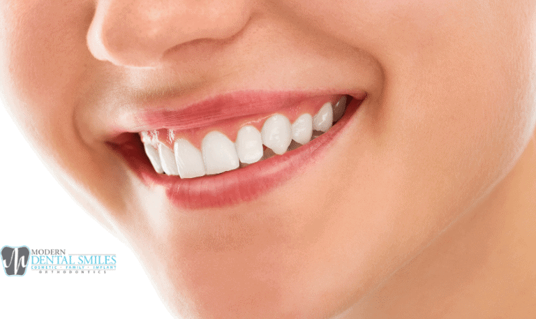 Patient satisfaction digital restorations