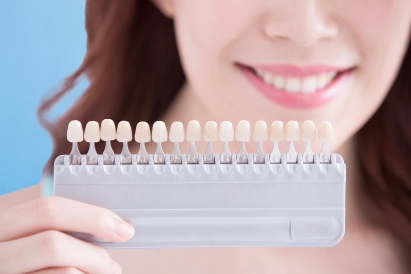 Transform Your Smile: The Porcelain Veneer Journey