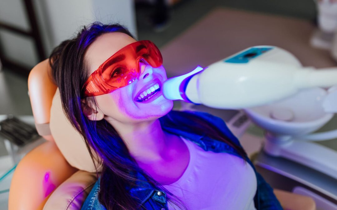 Teeth Whitening: Professional vs DIY – What’s Best?