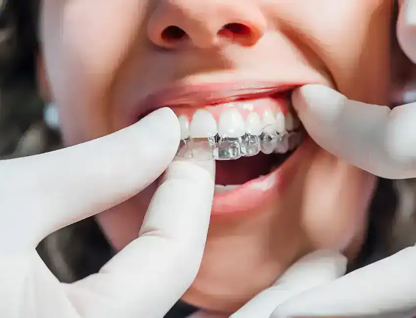 teeth shifted