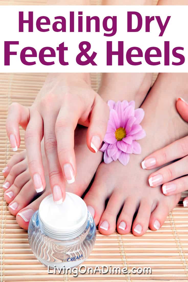 Healing Dry Feet And Cracked Heels 