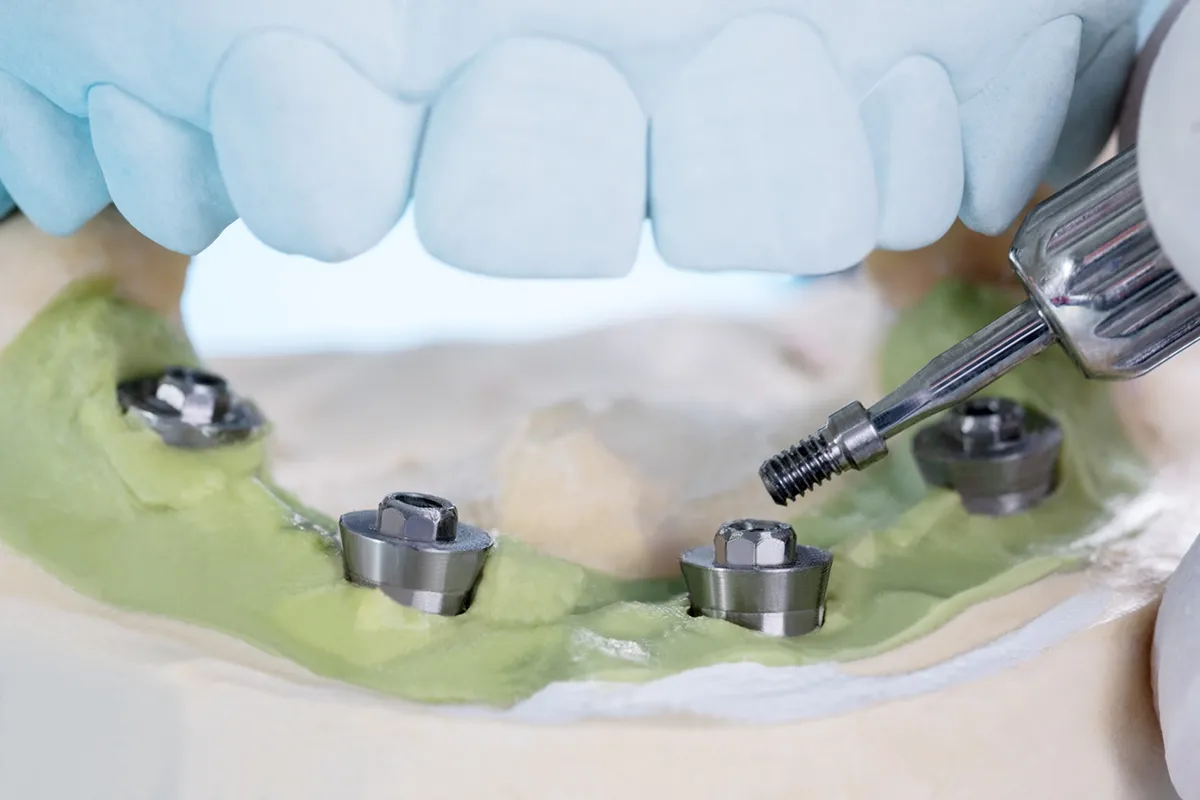Predictable Dental Excellence – The VCAD Philosophy