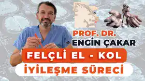 felçli el iyileşme süreci