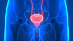 treatment of Prostate Cancer with Dendritic Cells
