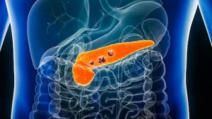 immunotherapy for pancreatic cancer