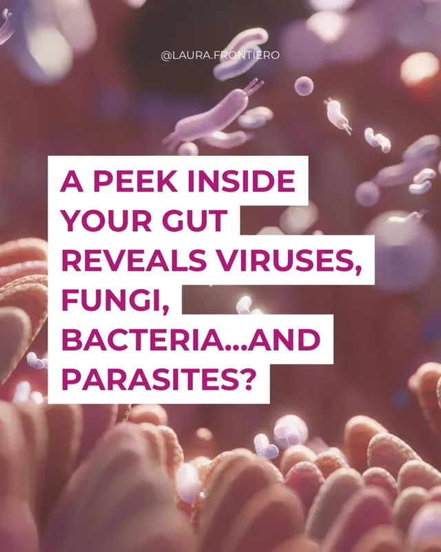 You don’t have to travel abroad to pick up a parasite,  research shows 1 in 4 people in industrialized countries have an active infection.

Parasites do more than cause digestive upset, they steal your nutrients, drain your energy, and can even reprogram your immune system to protect them instead of you.

That chronic inflammation, brain fog, joint pain, or autoimmune flare that won’t calm down? It might be more than “stress” or “hormones.”

Here’s the good news: your body already knows how to heal once the burden is removed.

-Start by cutting back on sugar and refined carbs, parasites thrive on glucose.
-Focus on liver and gut support (fiber, cruciferous veggies, hydration).
-Manage stress. Cortisol suppression makes your immune defenses weaker.
-Work with a practitioner who can test and guide a safe, natural cleanse.

Your gut is your foundation, when it’s balanced, everything else follows.

To find out if gut testing is right for you, comment GUT below and I will send you a DM to get started!
.
.
.
.
.
#guthealth #parasites #parasitesymptoms #immunehealth #protectyourimmunesystem #rootcause #functionalhealth #liversupport #gutsupport