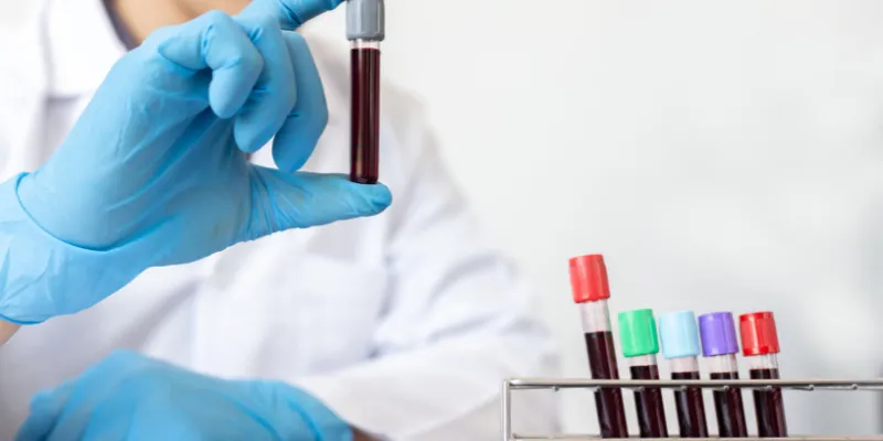 kiểm tra doping là gì