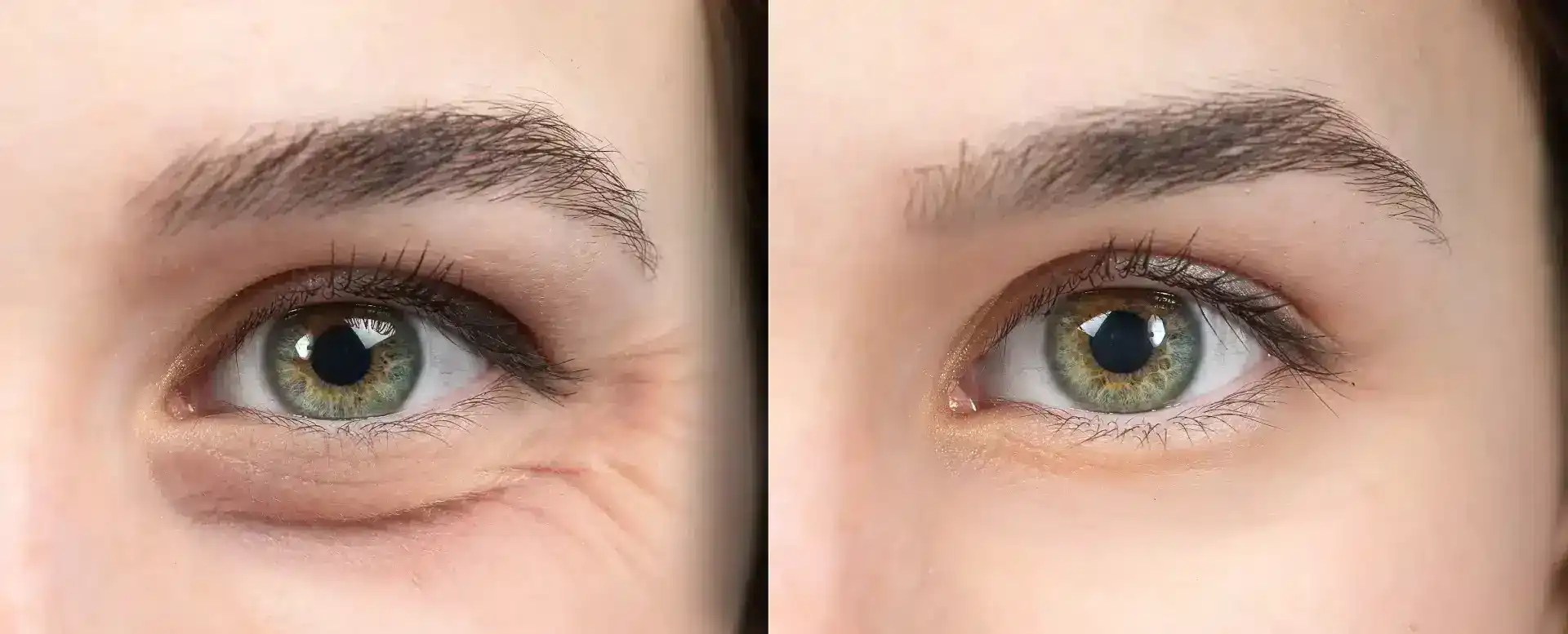 box before and after