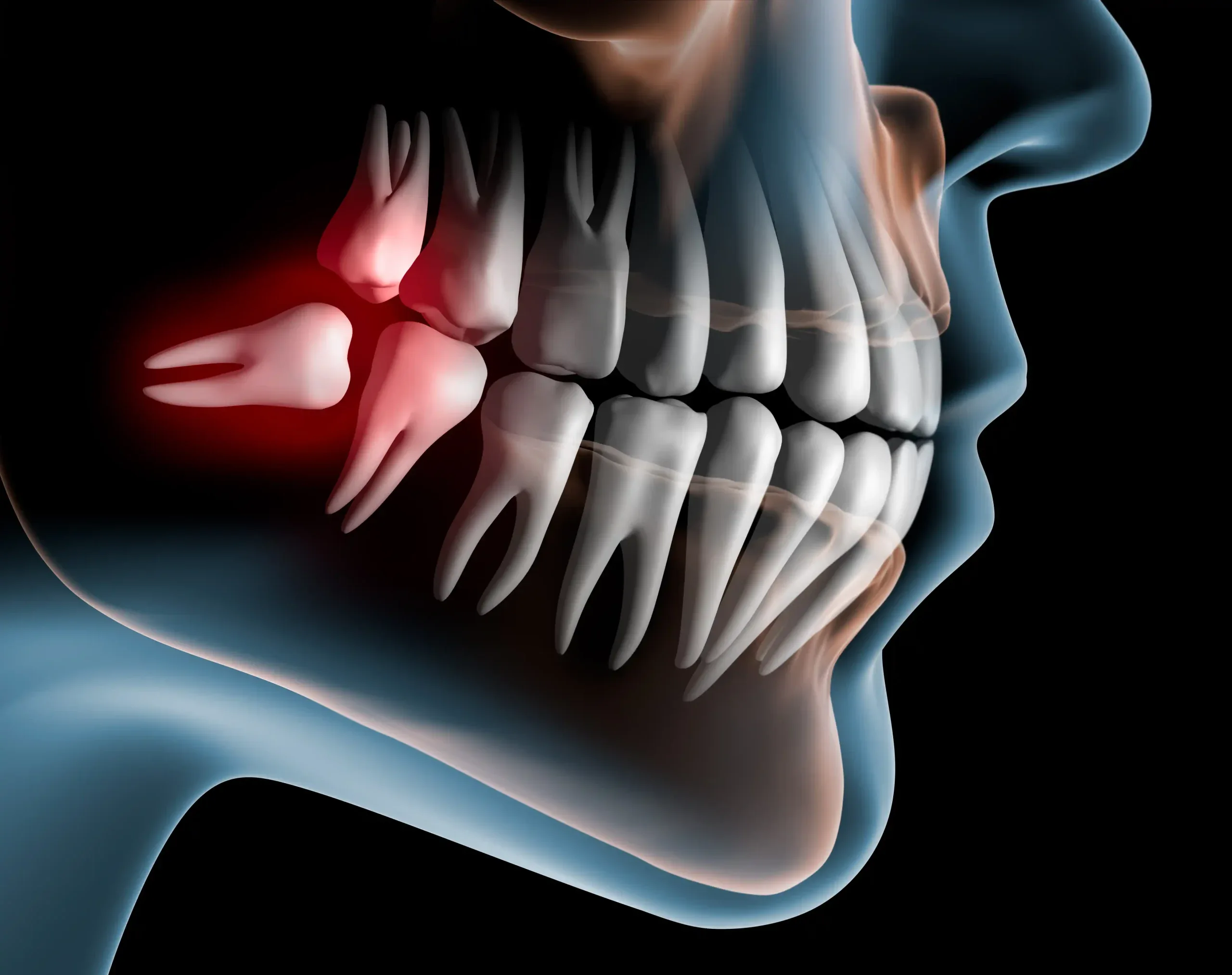 Denti del giudizio Studio del bianco scaled