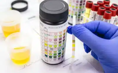 What Happens After a Specimen Is Collected?