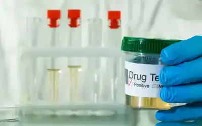 The Benefits of Using a Drug Testing Services Provider