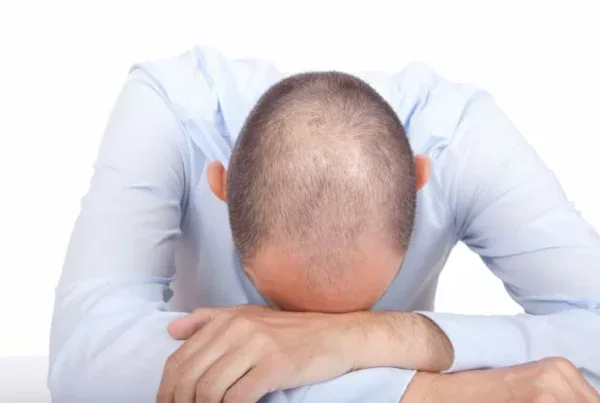 What causes premature hair loss?