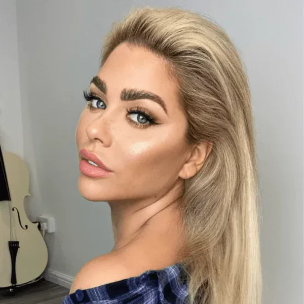 after eyebrow transplant