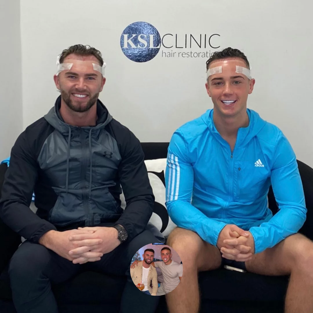 How to choose the best hair transplant clinic