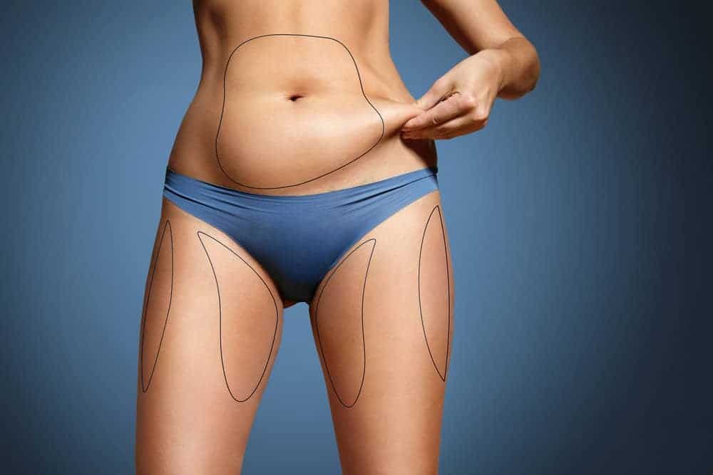 How Long Do the Best Emsculpt Results in McLean