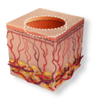 skin1