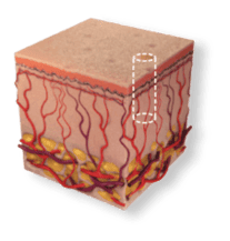 skin2