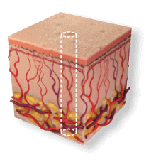 skin4