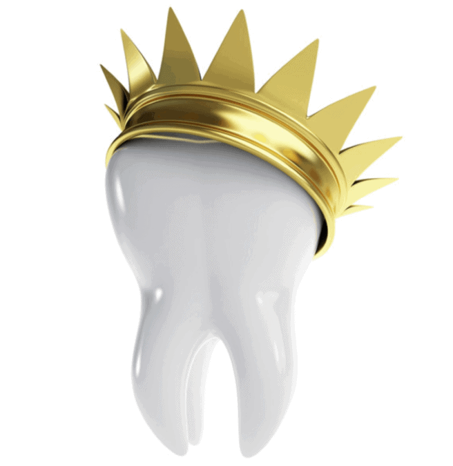 What is a dental crown or a dental bridge?