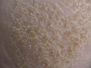 Tips Treatment For Baby Dry Scalp In Aug 2021 Kidsaversnetwork Com