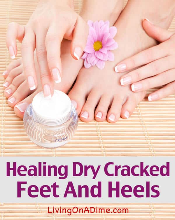 heal cracked heels fast