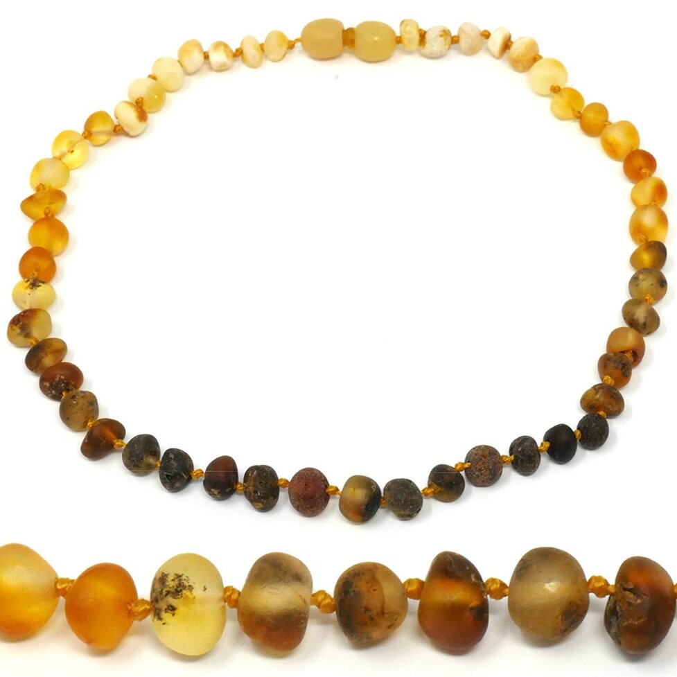 Amber Teething Necklaces Do They Work Are They Safe