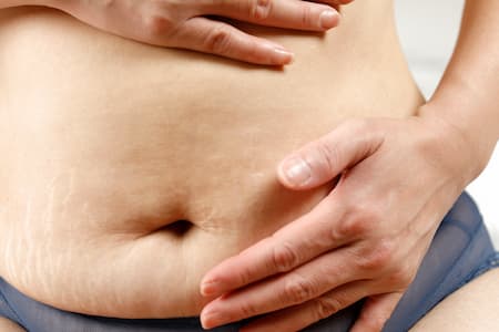 Stomach