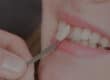 are-veneers-right-for-me-banner
