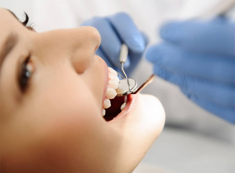 common-signs-of-tooth-decay-strip4