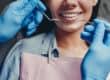 cosmetic-dentistry-faqs-banner