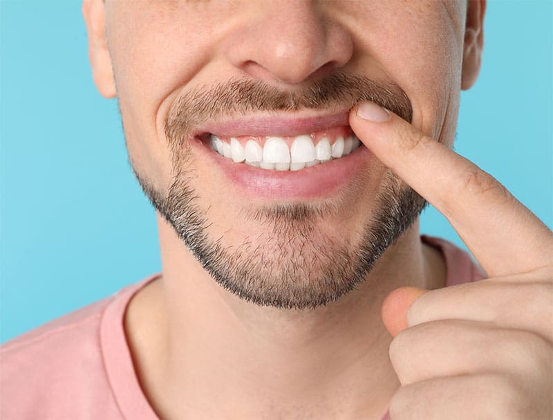 cosmetic-dentistry-faqs-strip3