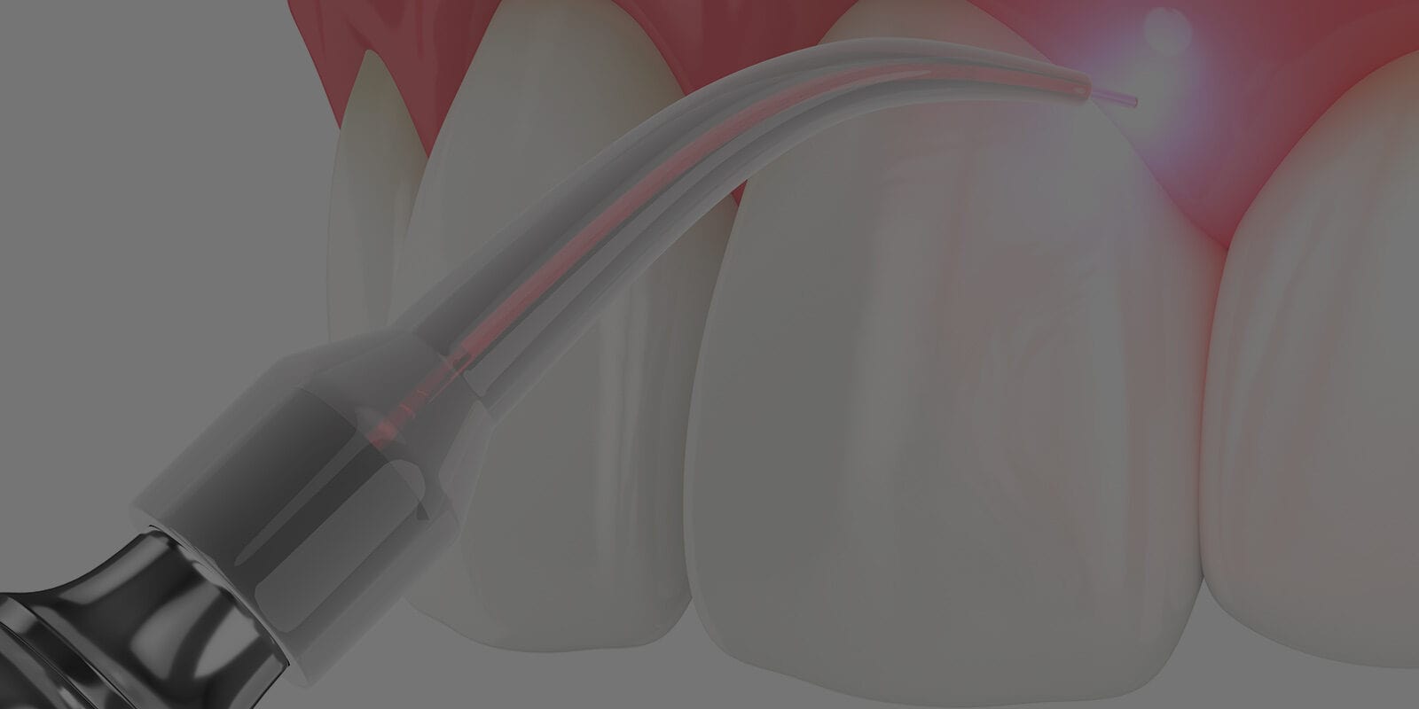 laser-gum-therapy_banner
