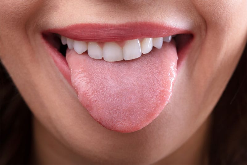 should-you-be-caring-for-your-tongue-strip1