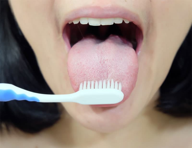 should-you-be-caring-for-your-tongue-strip2
