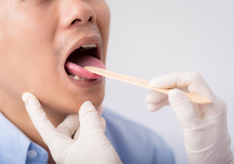 should-you-be-caring-for-your-tongue-strip3