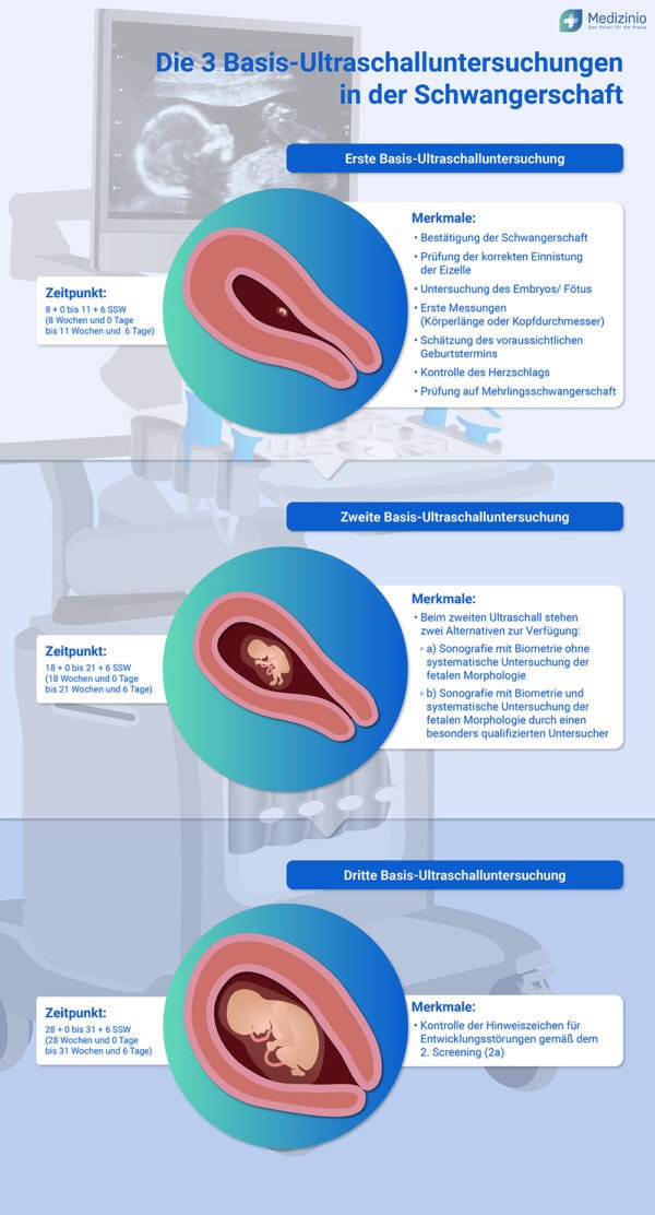Was Passiert Wenn Man In Der Schwangerschaft Schwer Hebt Ultraschall in der Schwangerschaft: Das sollten Sie wissen!