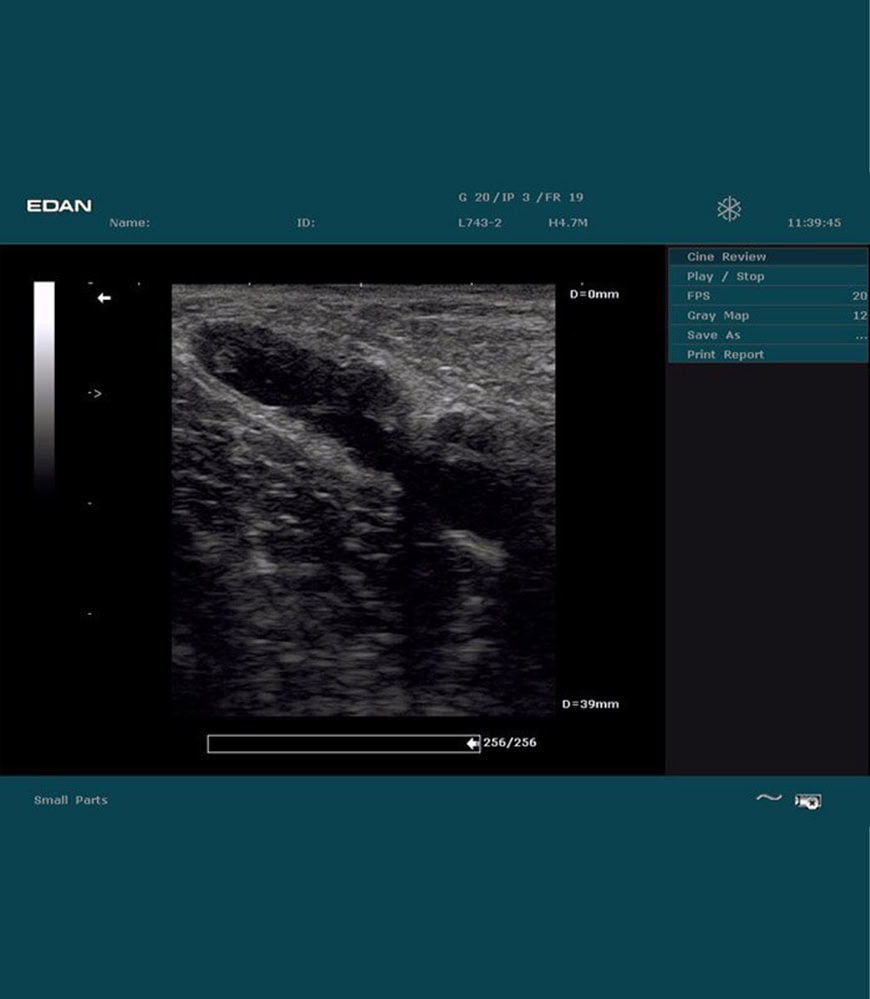 EDAN DUS 60 Ultraschallbild Small Parts