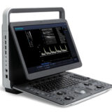 Sonoscape E1 tragbares Ultraschallgerät