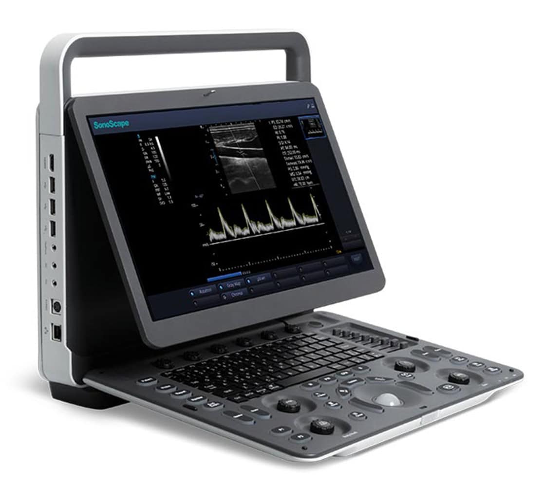 Sonoscape E1 tragbares Ultraschallgerät