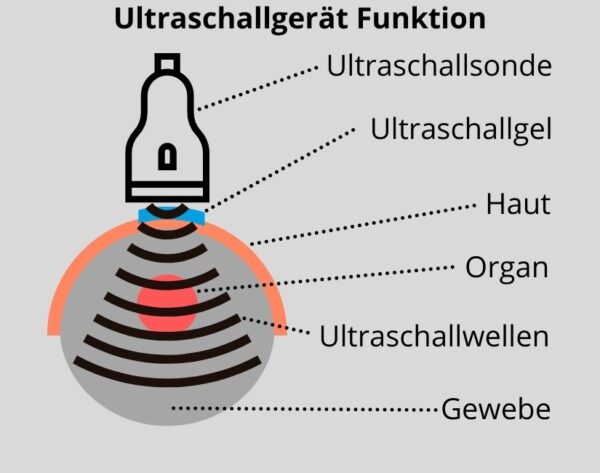 Kann Man Beim Ultraschall Alles Sehen medizinio.de